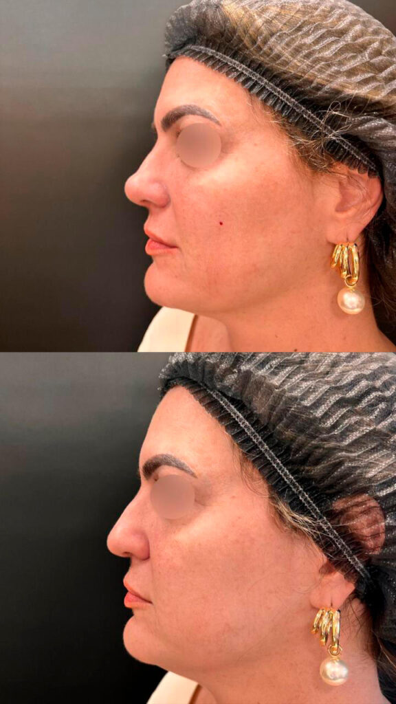 letycia_0004_WhatsApp Image 2025-05-12 at 09.14.28 (2)